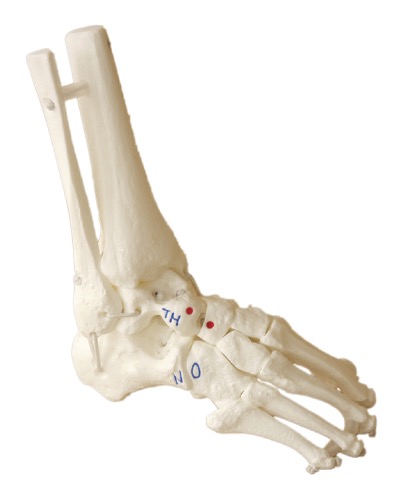 [MD-MOD-CLUBFOOT] Modèle de pied bot Mitchell Ponseti® 