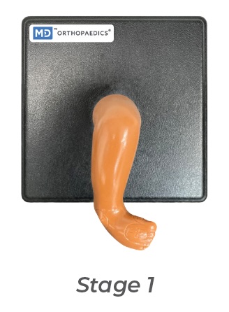 [MD-MOD-STAG1-RW] Modèle de cast Mitchell Ponseti® - stage 1 - DROIT