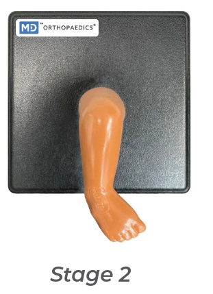 [MD-MOD-STAG2-RW] Modèle de cast Mitchell Ponseti® - stage 2 - DROIT 